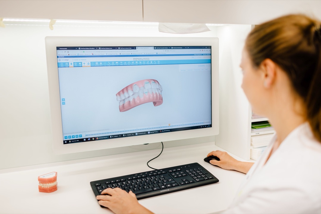 3D Simulation der Zahnregulierung